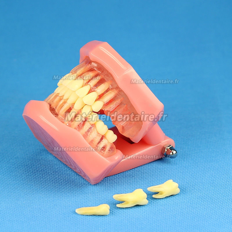 YZDKJDZ Modèle De Dents, Modèle De Dent Orale Orthodontique avec 32 Dents  Amovibles, Modèle De Gencive Molle pour Typodont, pour Démonstration De